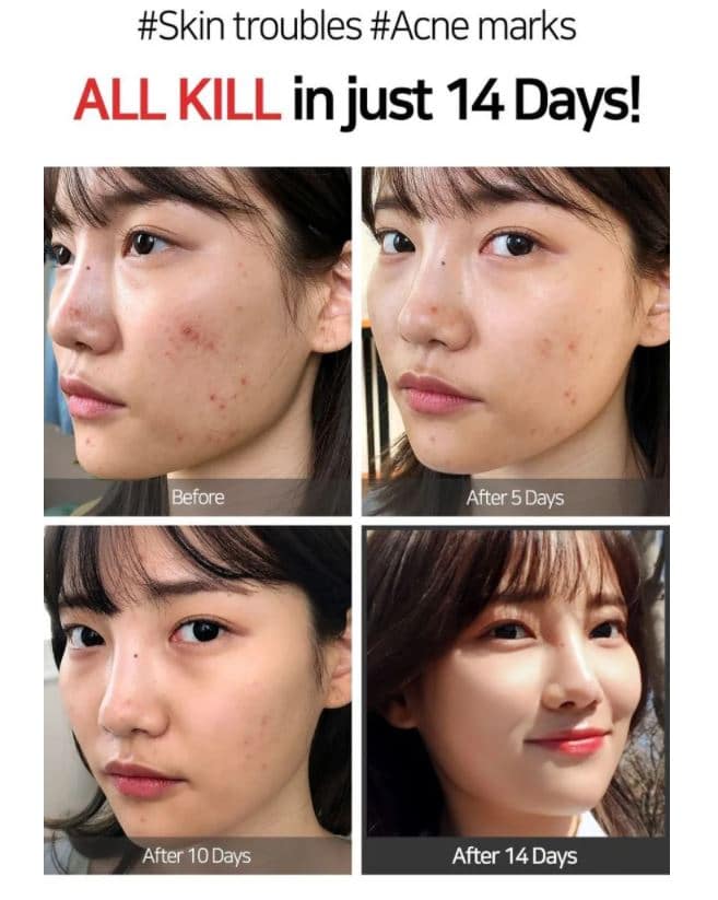 Some By Mi Aha Bha Pha 14 Days Super Miracle Spot All Kill Cream 30ml. 