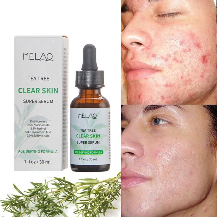 MELAO Natural Tea Tree Liquid Face Serum Acne Essence Lightening Fine Lines Shrink Pores Moisturizing Oil Control Face Skin Care -30ML