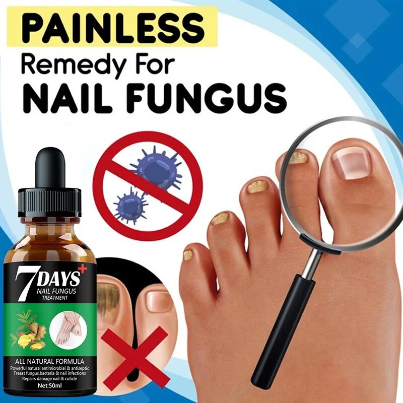 7DAYS Repair Nail Fungus Treatments Essence Foot Care Serum Toe Nails Fungal Removal Gel Anti-Infection Onychomycosis Care Tool. 