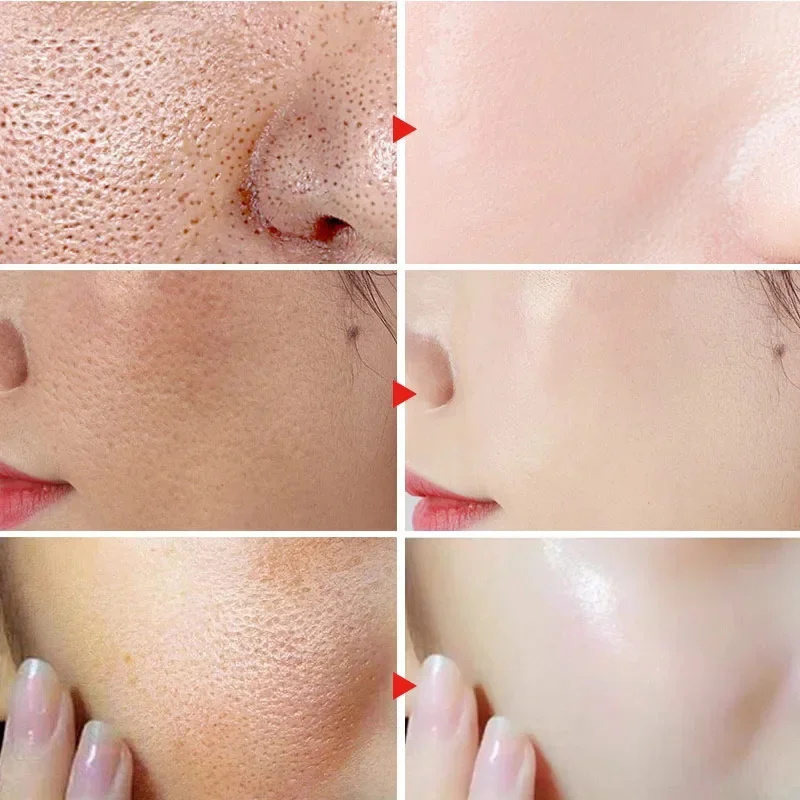 Salicylic Acid Pore Shrinking Cream Quick Eliminate Large Pores Remove Blackehead Tighten Repair Face Smooth Skin Care Products. 