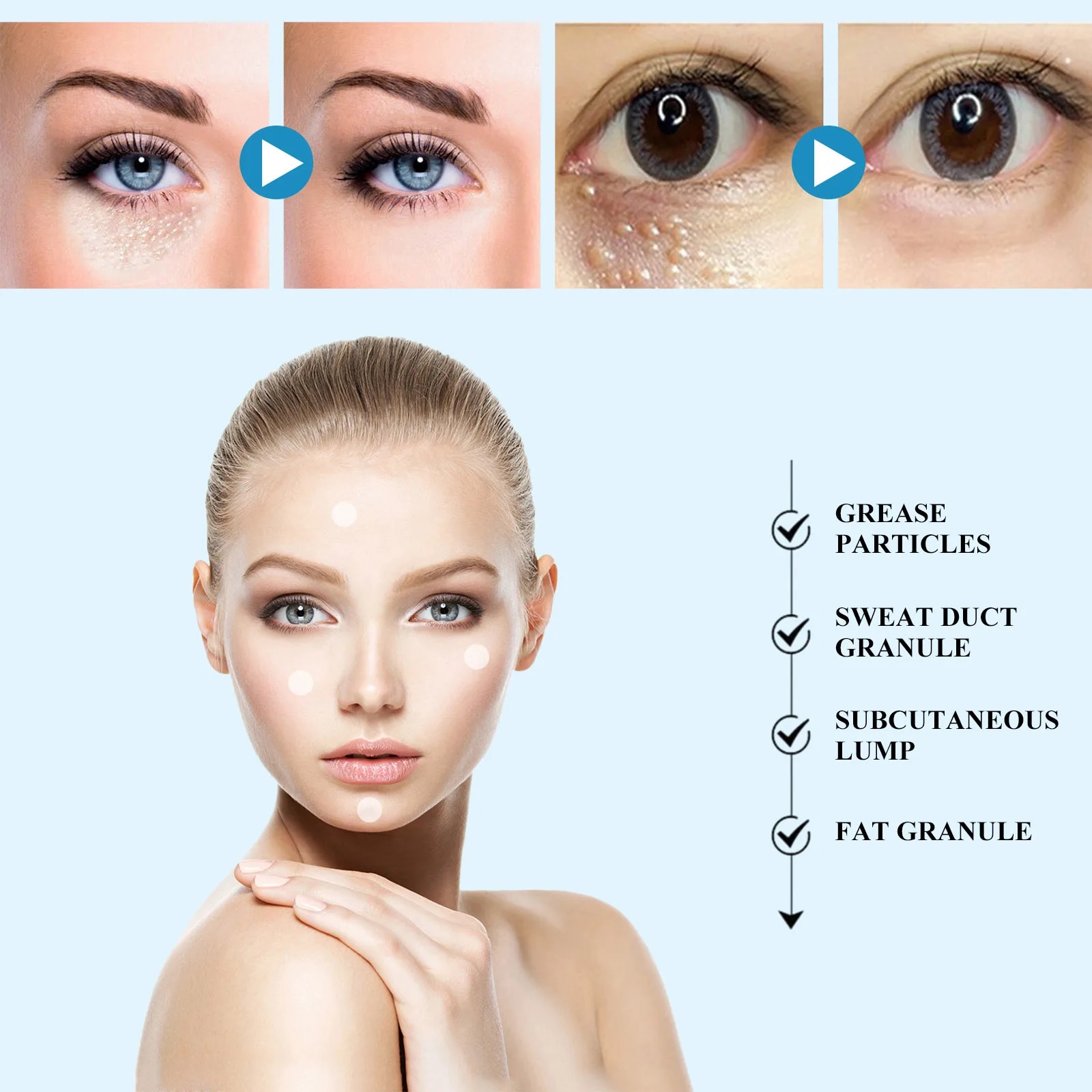 New 144patch/Box Milia Remover Eye Cream Nourishing Moisturizing Repair Smoothing Eye Patches Eyes Pad. 