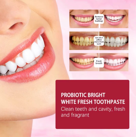 Yayashi sp-4 Probiotic Toothpaste freshen breath maintain oral health whiten teeth Stain Removing Sp-4 Toothpaste Teeth Cleaner Plaque Remove. 