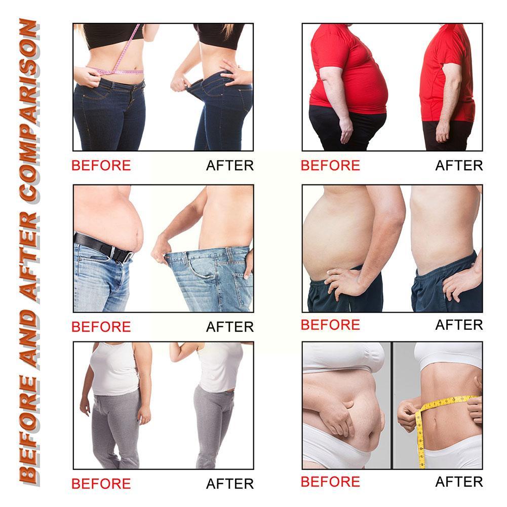 Grapefruit Cellulite-Targeting Essential Oil for Body Grapefruit Essential Oil for Cellulite Aromatherapy Cellulite Skin Bo K4Z9. 