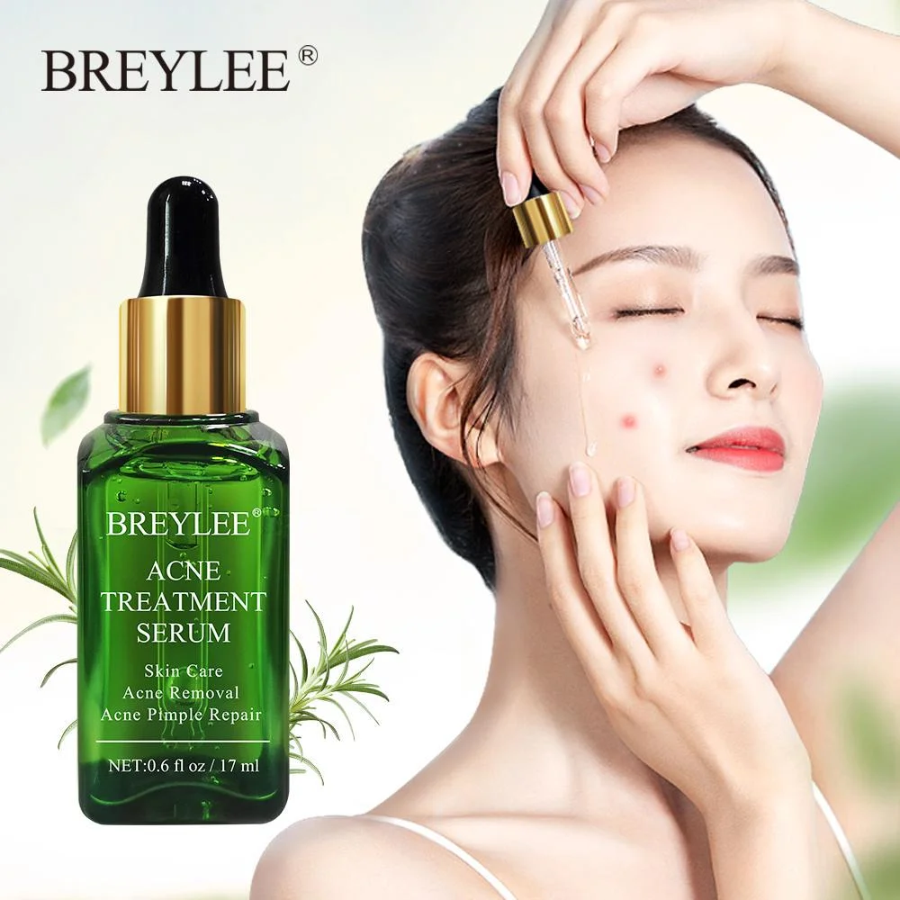 BREYLEE Acne Treatment Clear Skin Serum for Clearing Severe Acne, Breakout, Remover Pimple and Repair Skin-17ml