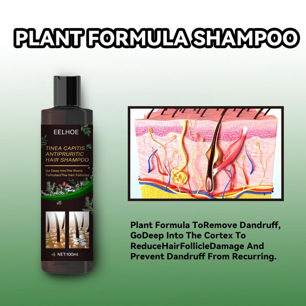 EELHOE 100ml Tinea Dispelling Anti-itching Shampoo Anti-dandruff Shampoo Hair Shampoo Treatment Oil Refreshing Control. 