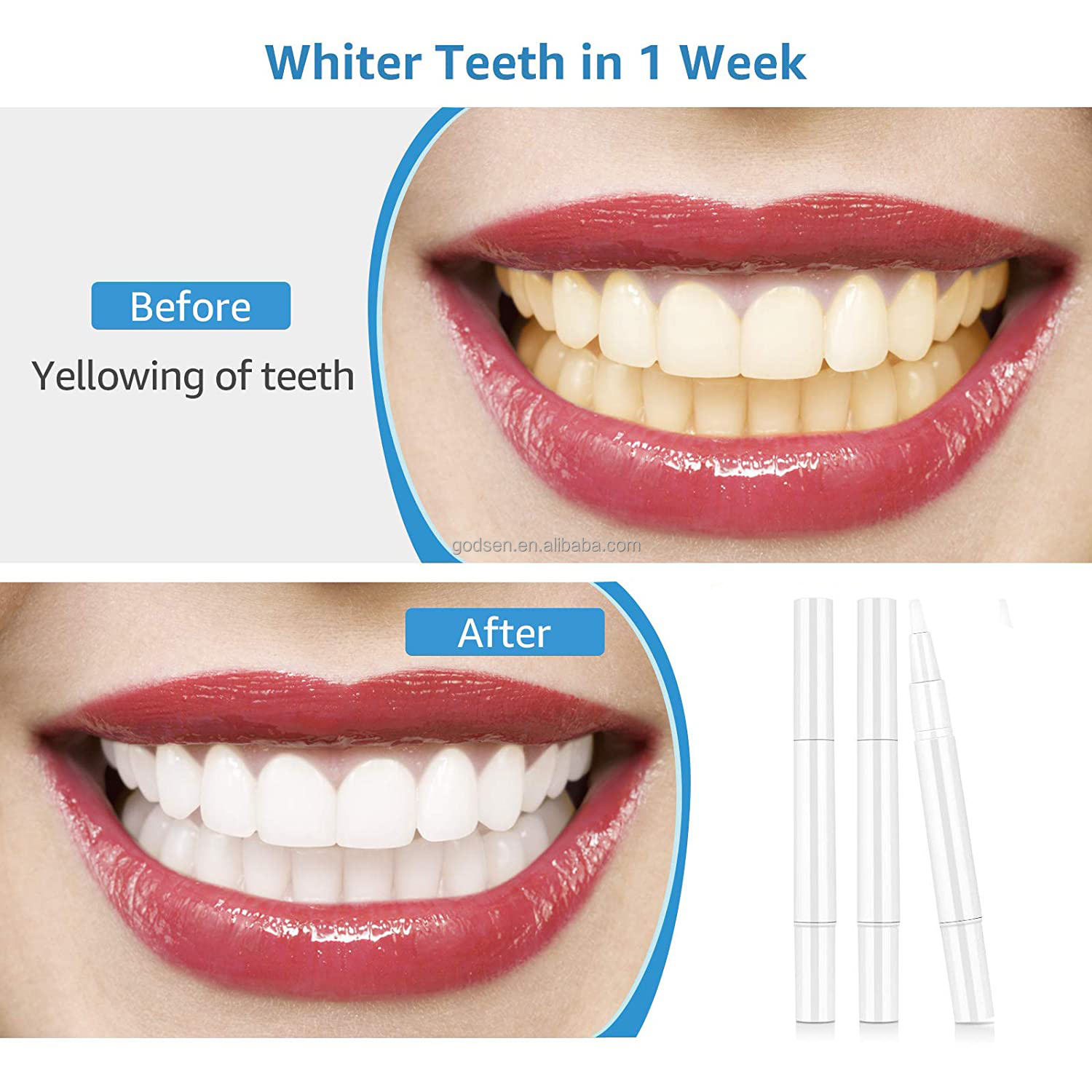 Hugely Popular  Carbamide Peroxide Whitening  Formula Descaling Bright White Teeth Whitening Pen