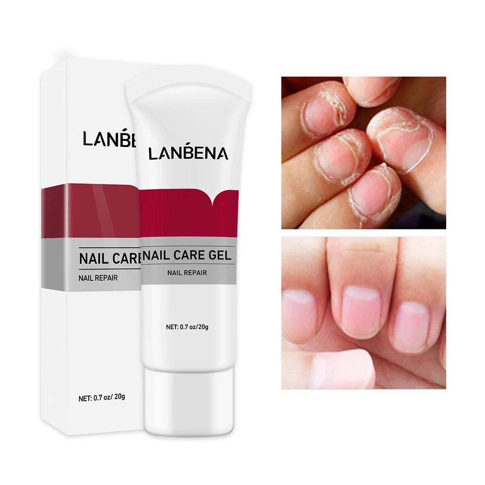 LANBENA Nail Care Gel Fungal Nail Treatment Remove Onychomycosis Nail Care Nourishing Effective against nail Hand And Foot Care-20GM