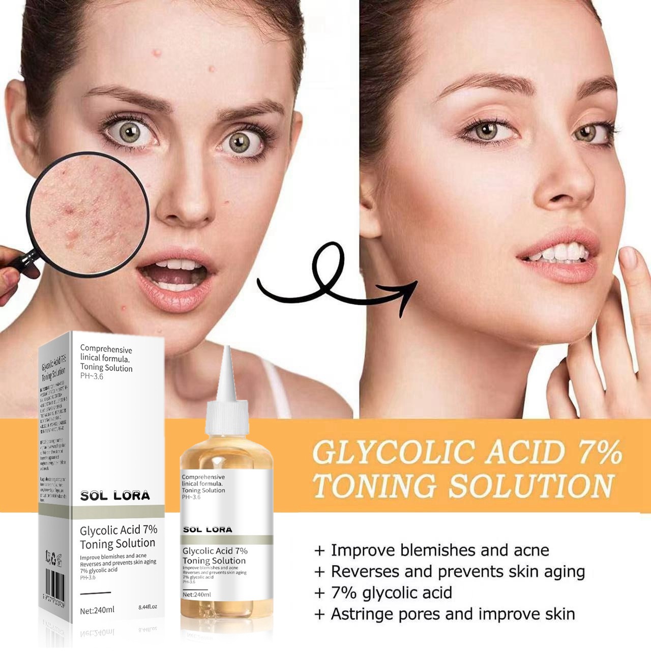 SOL LORA Glycolic Acid Lotion Anti-Acne Smallpox Diluting Anti-Closed Acne Skin Moisturizing Skin Rejuvenation Lotion. 