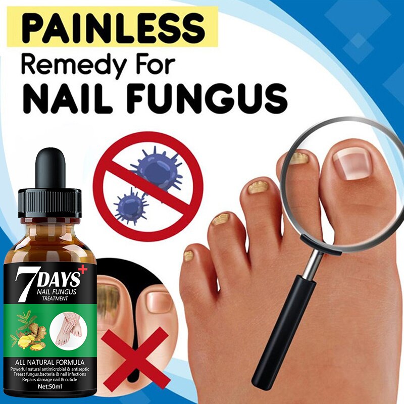 7DAYS Nail Fungus Treatment Essence Serum Care Hand and Foot Care Removal Repair Gel Anti-infective. 