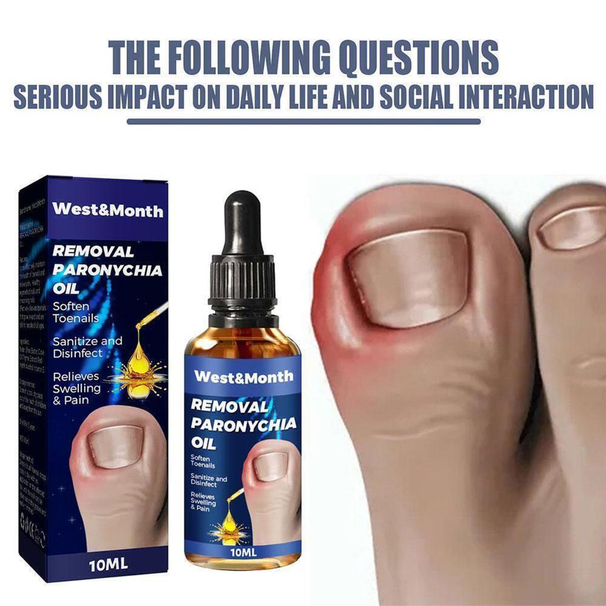 【Get the Perfect Fit】 German Toenailcare For Removing Paronychia, Ingrowing OilR Toenail K7Q7