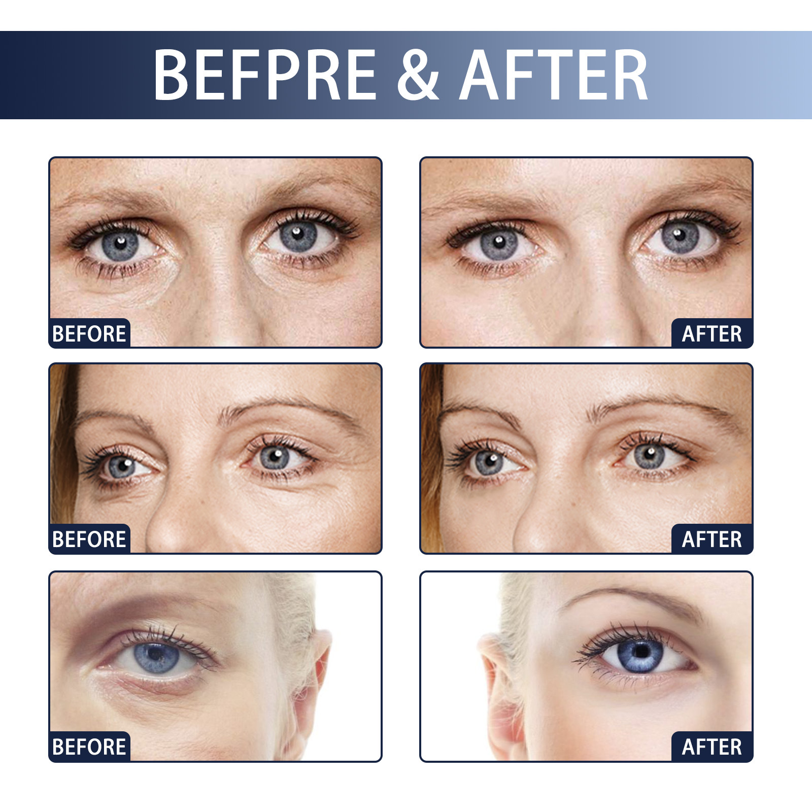 Jaysuing Instant Anti-Wrinkle Eye Cream Reduces the appearance of fine lines around the eyes, lifts and tightens the anti-aging moisturizer. 