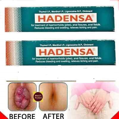 Hadensa Ointment piles Cream , fissures and fistula itching & pain bleeding F/SC 20gm ( Indian). 