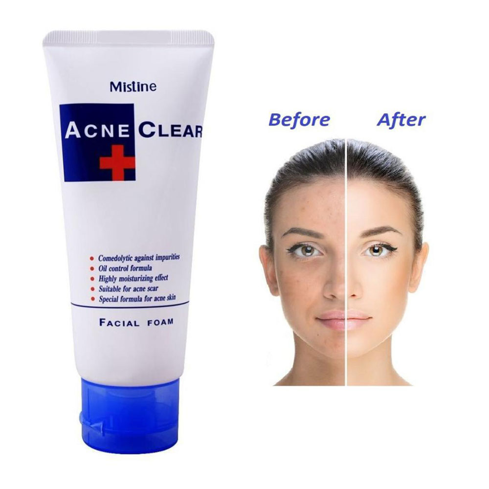 Mistine ACNE CLEAR FACIAL FOAM - arfaana.com