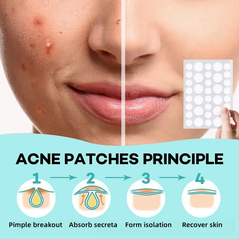 144pcs/box invisible acne patch wart patch remover pimple patch Anti-Acne Spots Marks Concealer Repair Sticker Waterproof. 