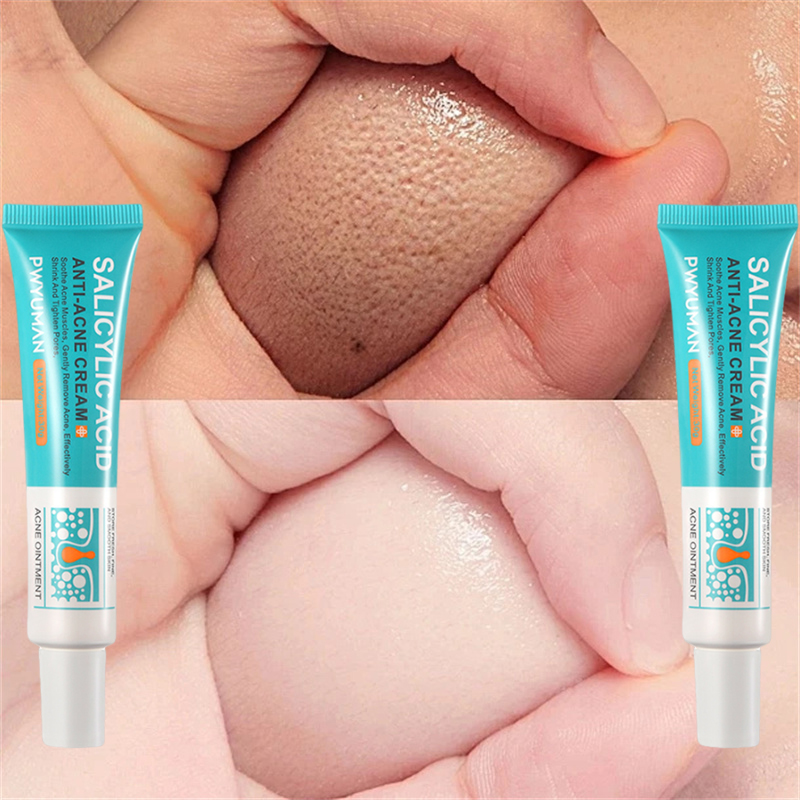Salicylic Acid Pore Shrinking Cream Quick Eliminate Large Pores Remove Blackehead Tighten Repair Face Smooth Skin Care Products. 