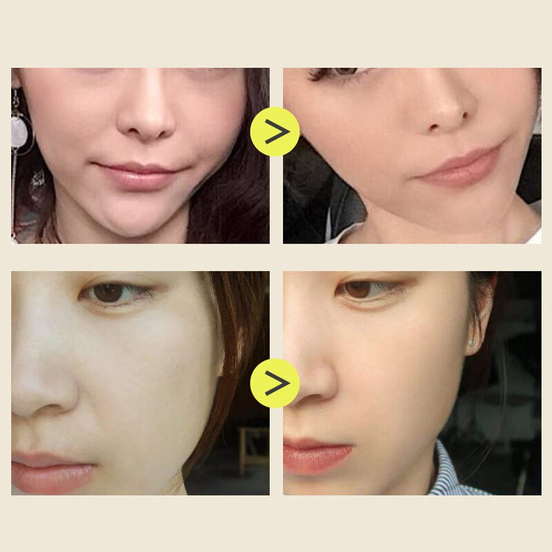 Silicone V Face Line Lifter Slimming Face Lifter Double Chin Wrinkle Removal Blow Breath Exerciser Masseter Muscle Slim Tools. 
