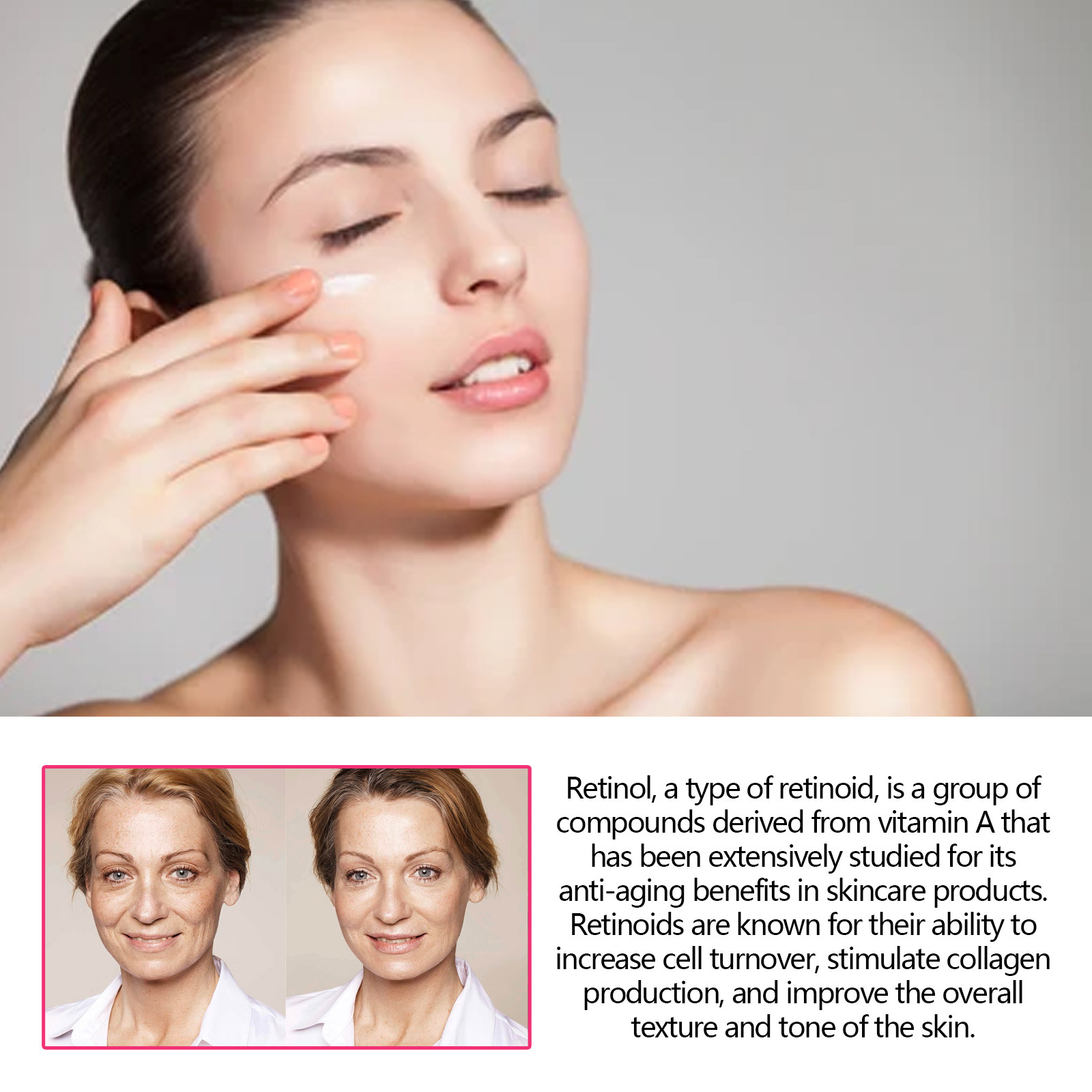 Eelhoe Retinol Eye Cream Stick Fading Wrinkle Wrinkles Increase Skin Elasticity Anti-Aging Firming Delicate Skin. 