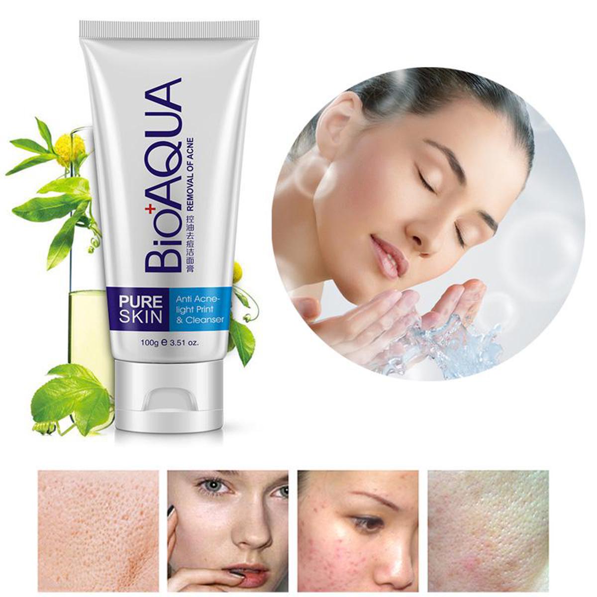 BIOAQUA Skin Care Acne Face Removal Cleanser Cream Spots Scar Blemish Mark - 100gm