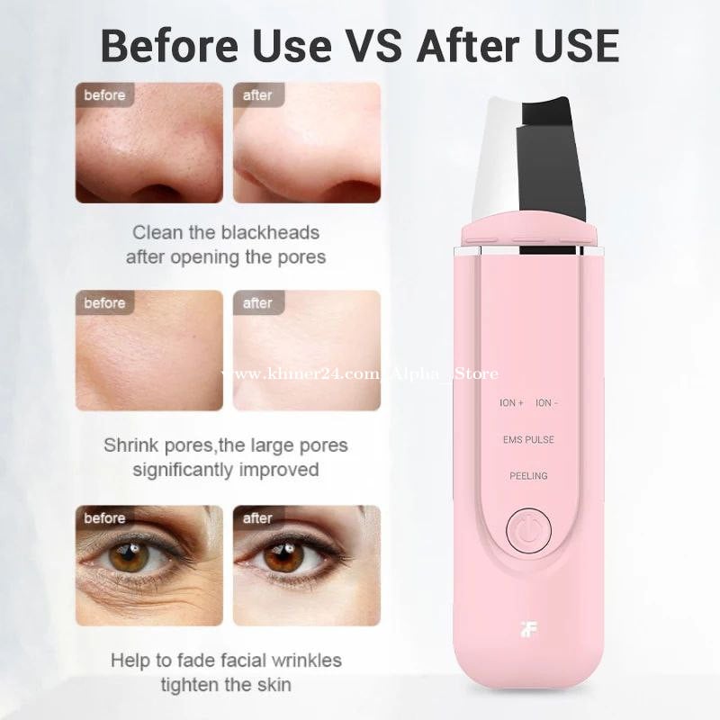 Xiaomi MS7100 InFace Ultrasonic Ionic Cleaner Face Scrubber Peeling Machine merek. 