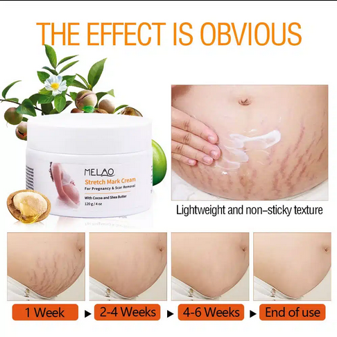 Melao Stretch Mark Cream 120gm For Pregnancy And Scar Removal Treatment With Cocoa And Shea Butter Belly Moisturizer