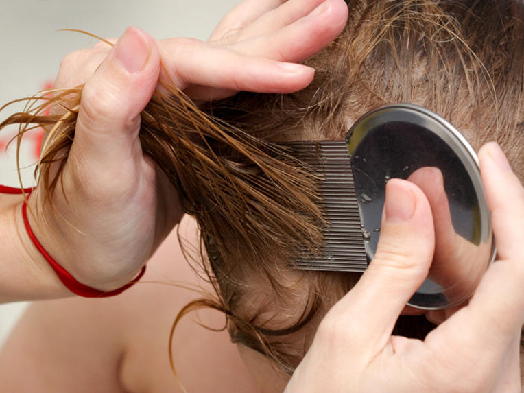 Lice Terminator Comb And All Nit Egg Free - Professional Stainless Steel Lice Removal Comb. 