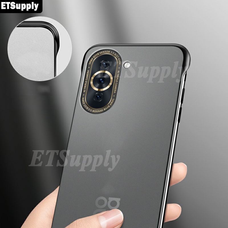 Sunrive Cover compatibile con HUAWEI nova 10 Pro, Custodia Case in molle Trasparente silicone Morbida Flessibile Antigraffio protettiva back custodie(tpu Cane alsaziano