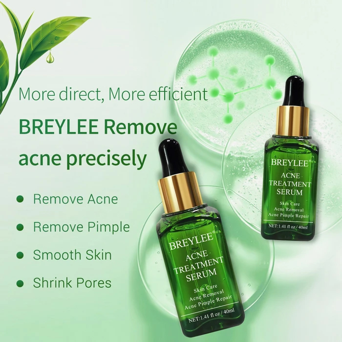 serum breylee acne