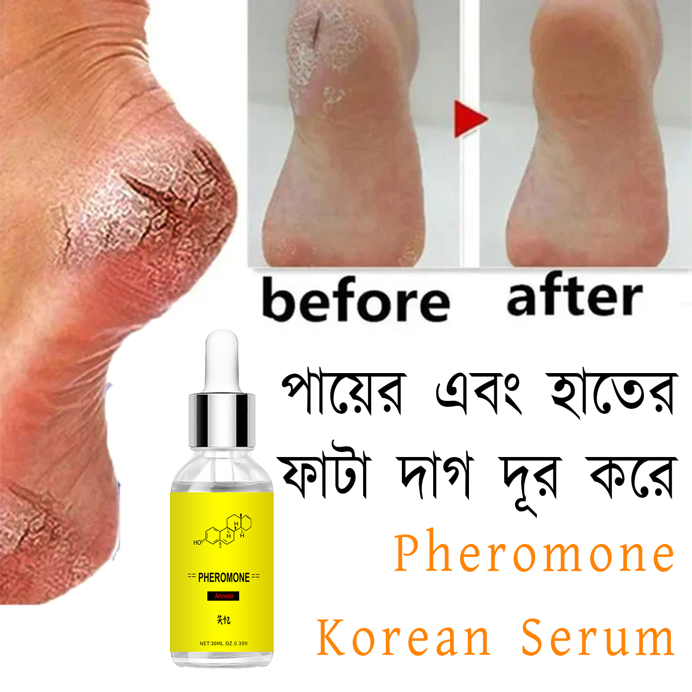 Foot Crack Relief Serum Pain Relief Foot Support to Eliminate cracks