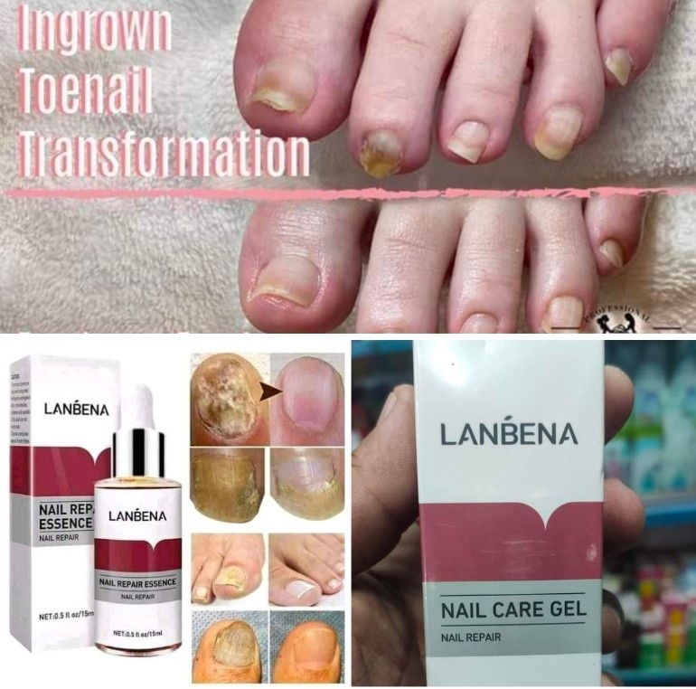 Lanbena Nail Repair Essence Serum