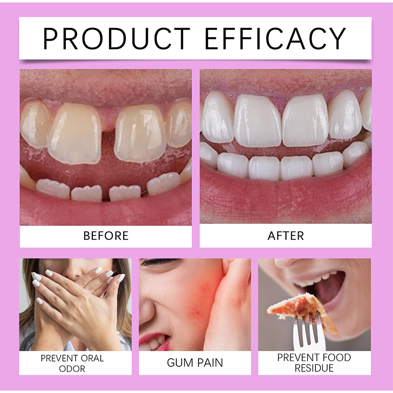 Comfort Denture Adhesives Glue Teeth Care Thermoplastic Denture Silicone Reline Kit Adhesive Cushion Friction Fixed Dentures. 