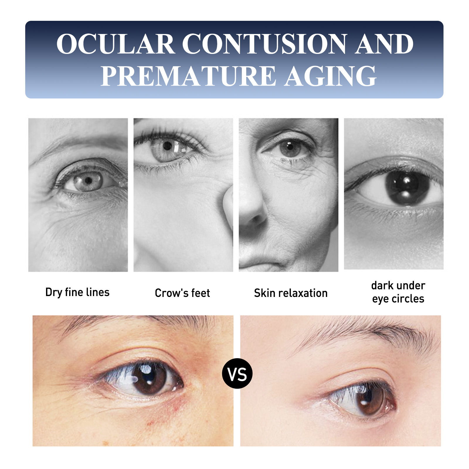Jaysuing Instant Anti-Wrinkle Eye Cream Reduces the appearance of fine lines around the eyes, lifts and tightens the anti-aging moisturizer. 