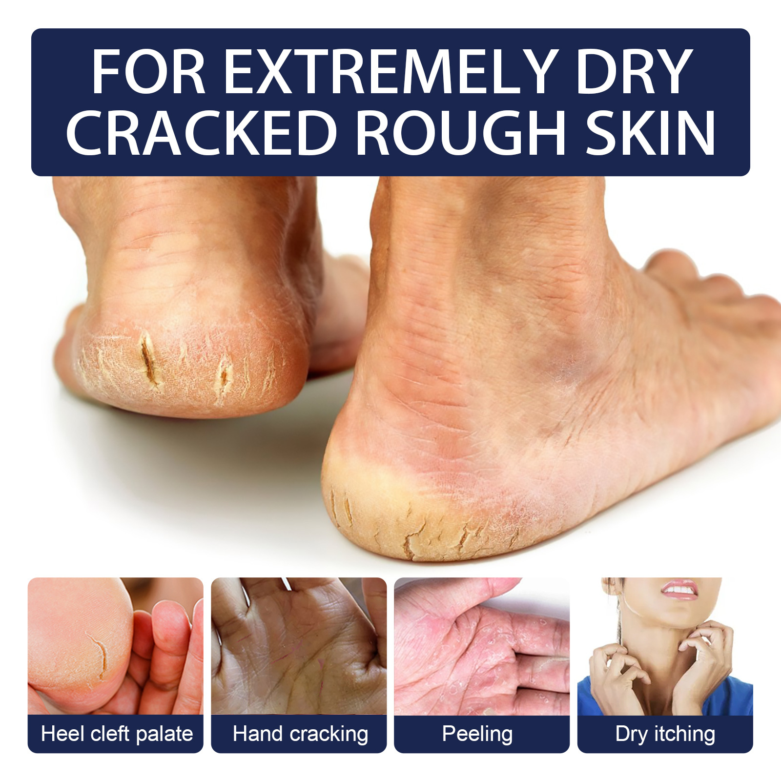 Jaysuing Foot and Hand Cream Heel Cracked Dry Repair Cream Hand
