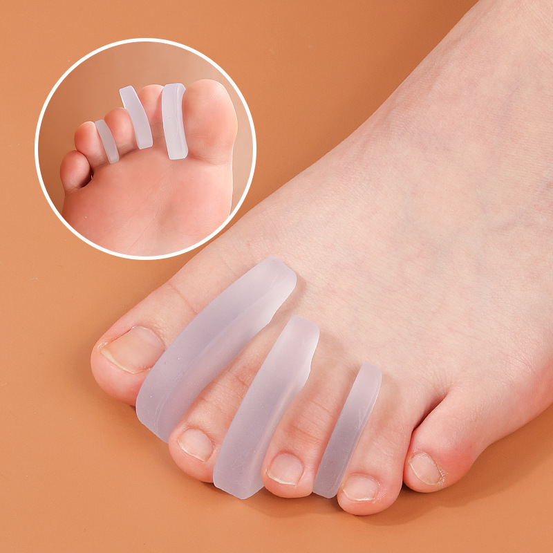 Bigfoot, hallux toe overlap, valgus, compression separator, thumb sac, syndactyly, sebs