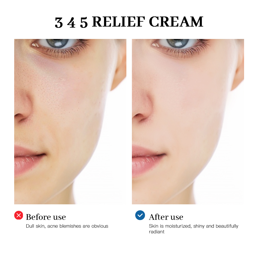 345 Relief Cream Comprehensive solution to skin problems Anti-sugar and antioxidant Brightening skin Improving acne marks Moistu. 