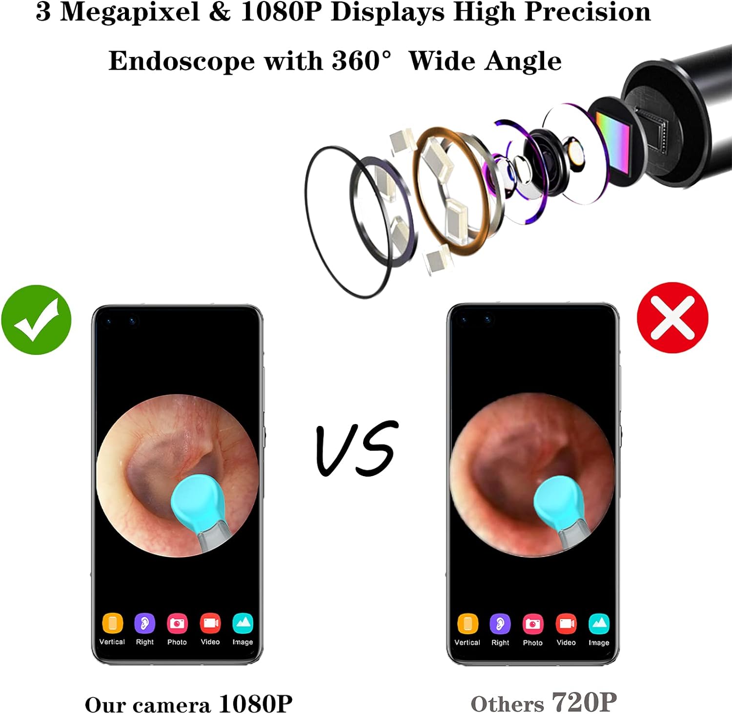 Xiaomi Bebird R1 Wireless Intelligent Visual Ear Stick Precision Endoscope. 