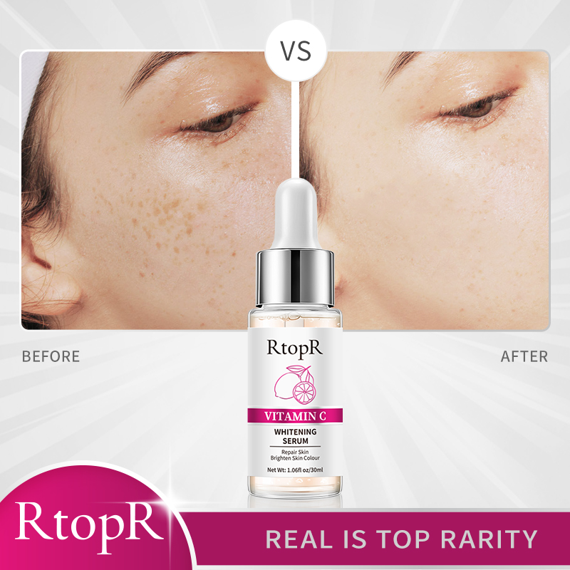 【DATA FROG Global MALL】(New) serum VC face essence fade dark spot anti-aging skin brightening moisturizing skin care 30ml