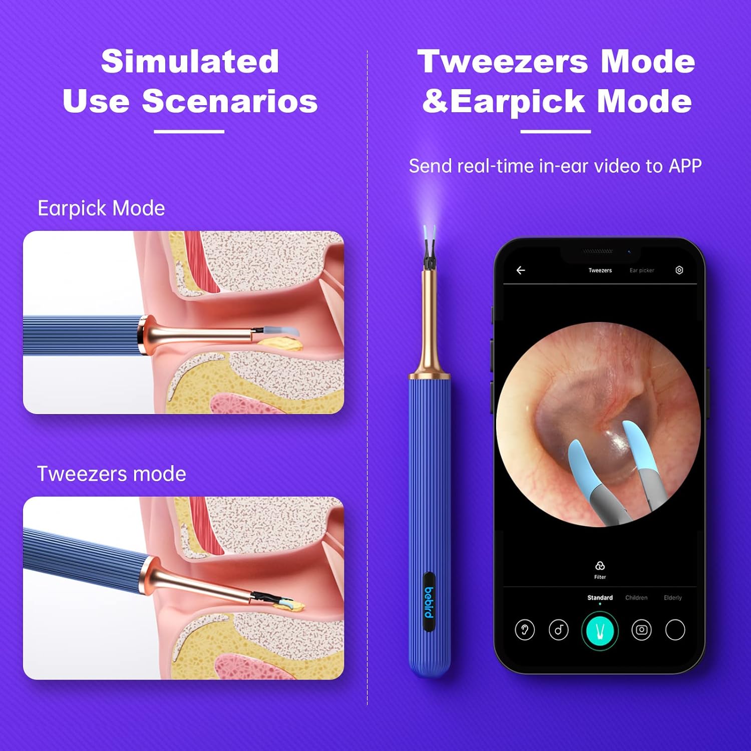 BEBIRD Note3 Pro Max Ultimate Version,10 Megapixel HD, All-in-1 Ear Wax Removal with Camera. 