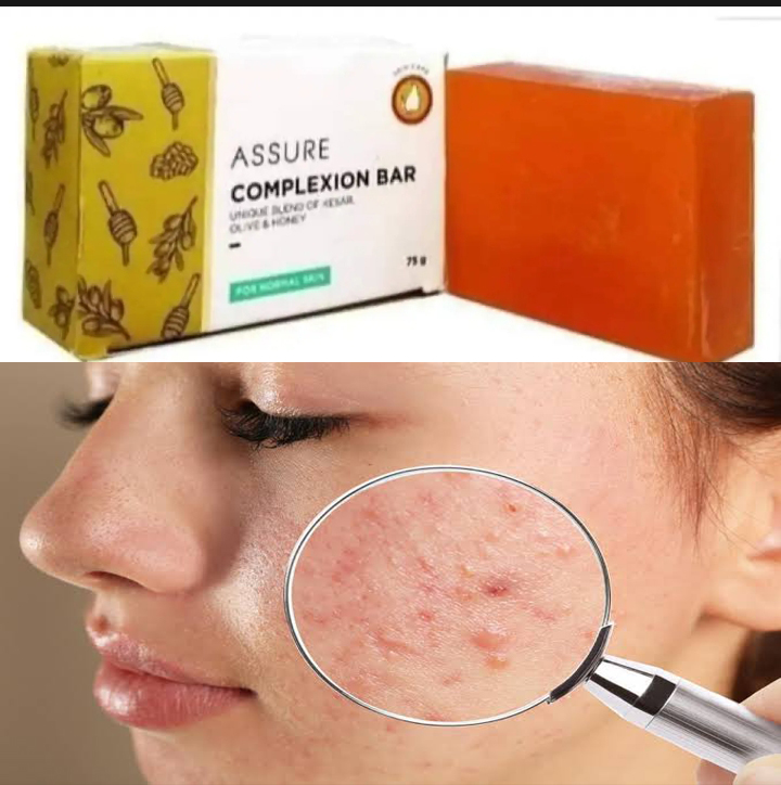 Assure Complexion Bar Soap  Indian  Honey,Olive & Jafran Enriched. 