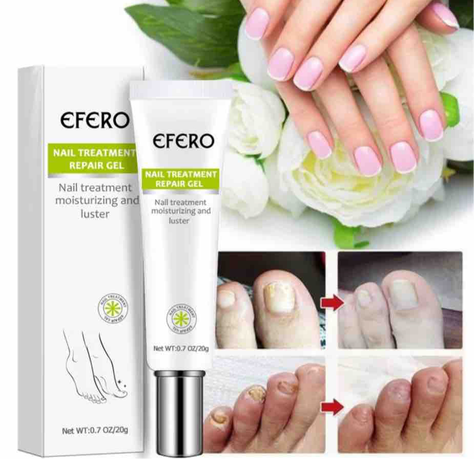 EFERO Anti Fungal Nail Repair Gel Treatment Anti Infection Serum Toe Nail Fungus Remover Nourish Essence Nail Care. 