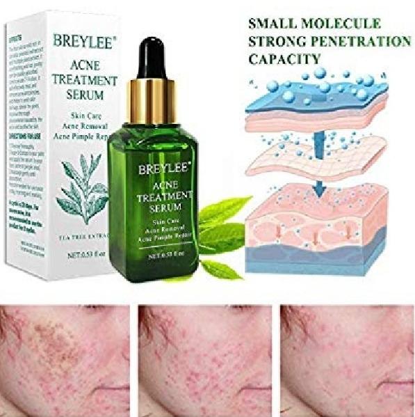 bd serum for acne