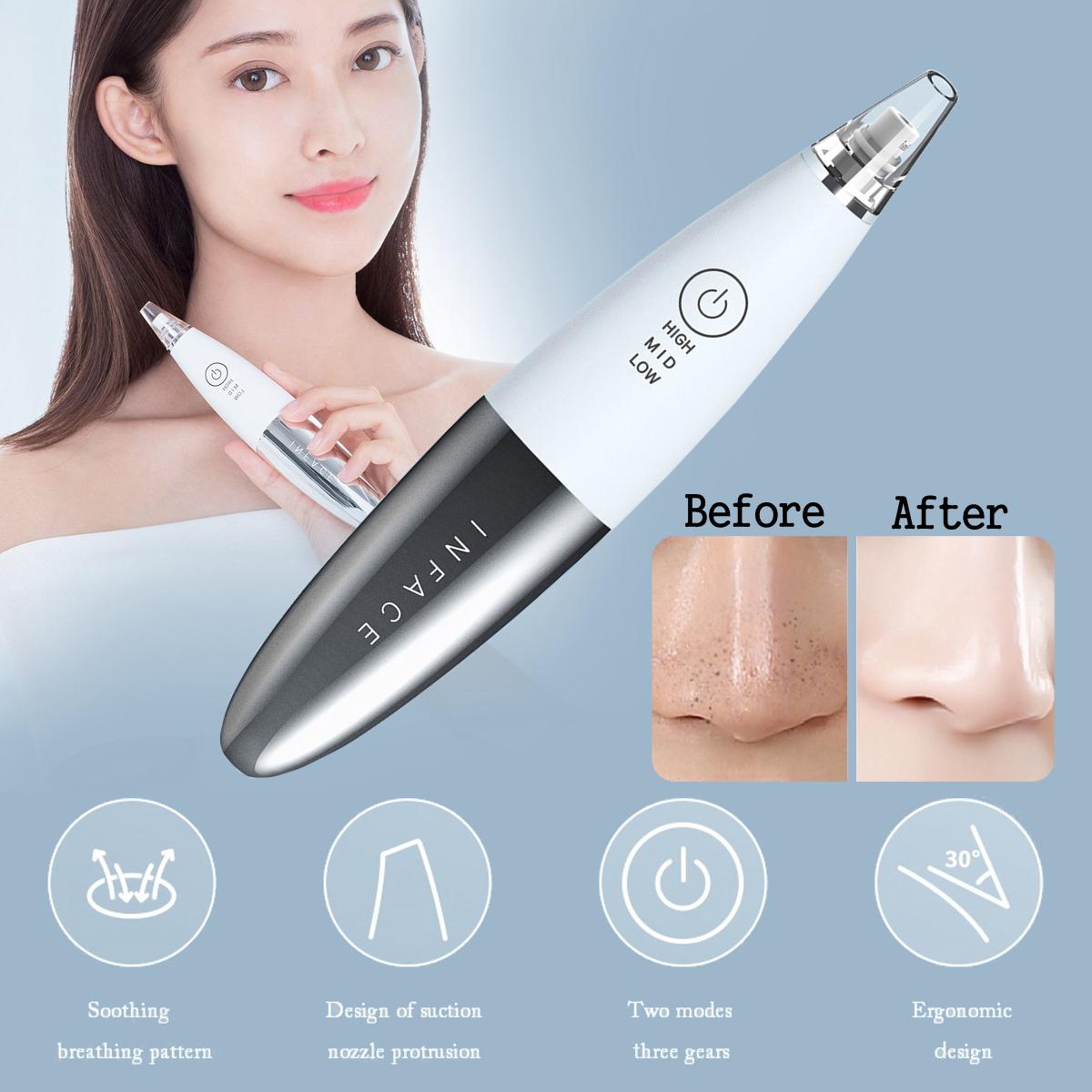 Xiaomi inFace Blackhead Remover Electric MS7000.