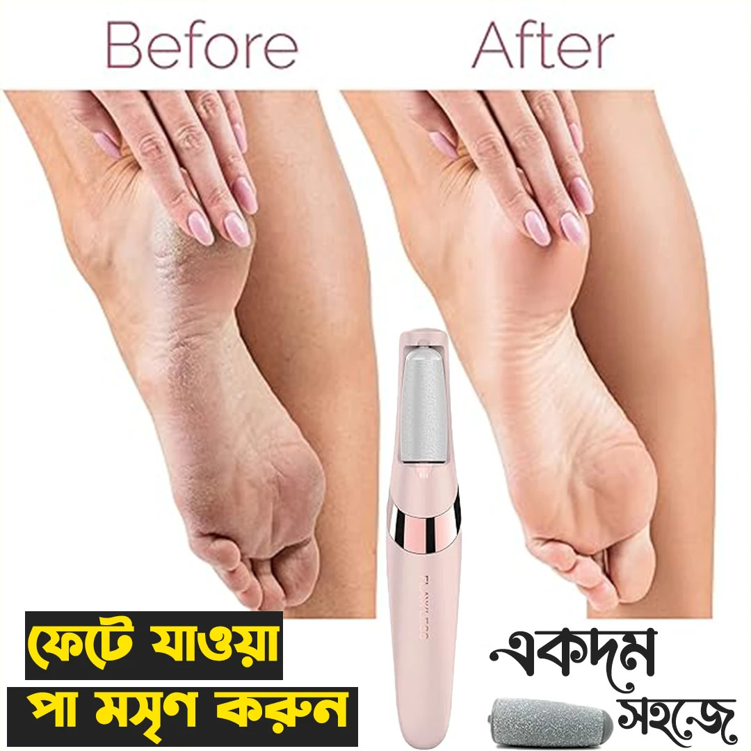 FLAWLESS PEDI ELECTRONIC PEDICURE TOOLS