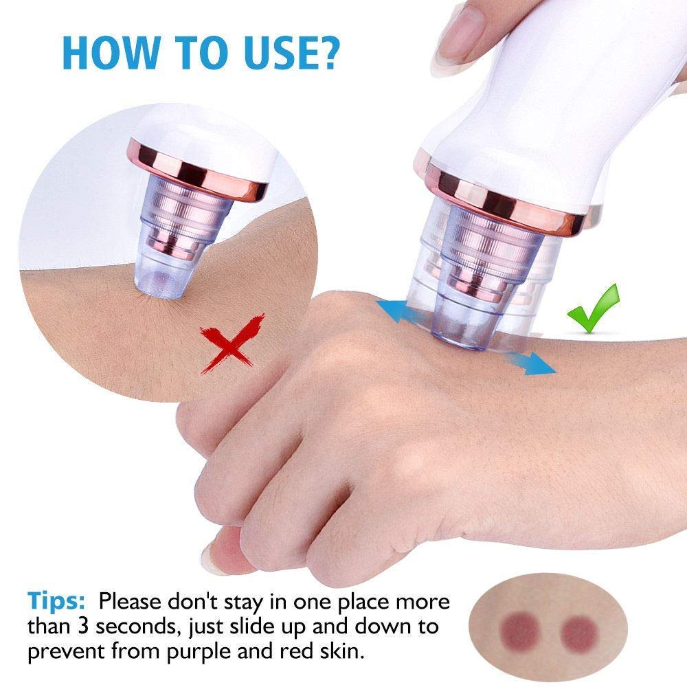 Telebrans As seen on TV 6 in 1 Multi-function Blackhead Remover Tools,Electric Derma suction Machine,USB Rechargeable Acne Pimple Pore Cleaner Vacuum tool - Facial Cleanser Device for Nose & Skin Care. 