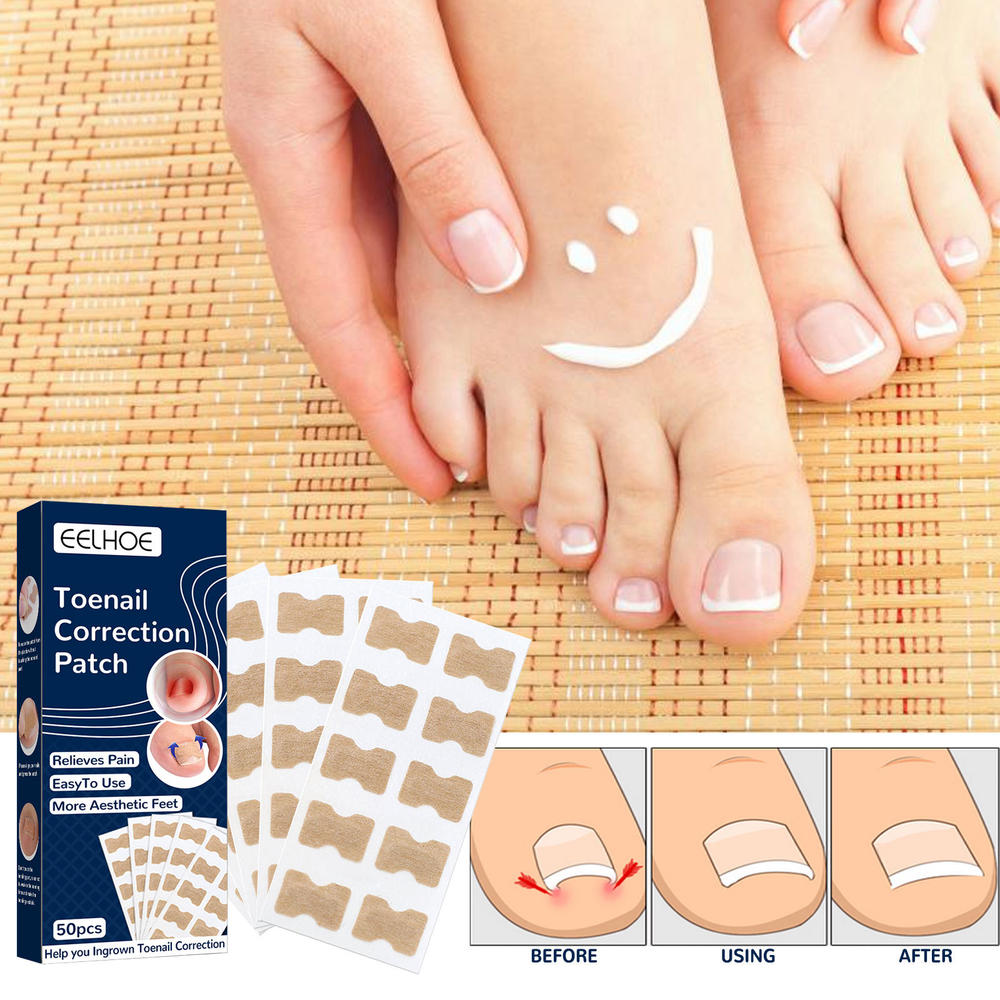 Ingrown Toenail Correction Patch Glue-Free Ingrown Toenail Corrector Strip Painless Pedicure Toenail Corrector Patch With Nail Correction Tool