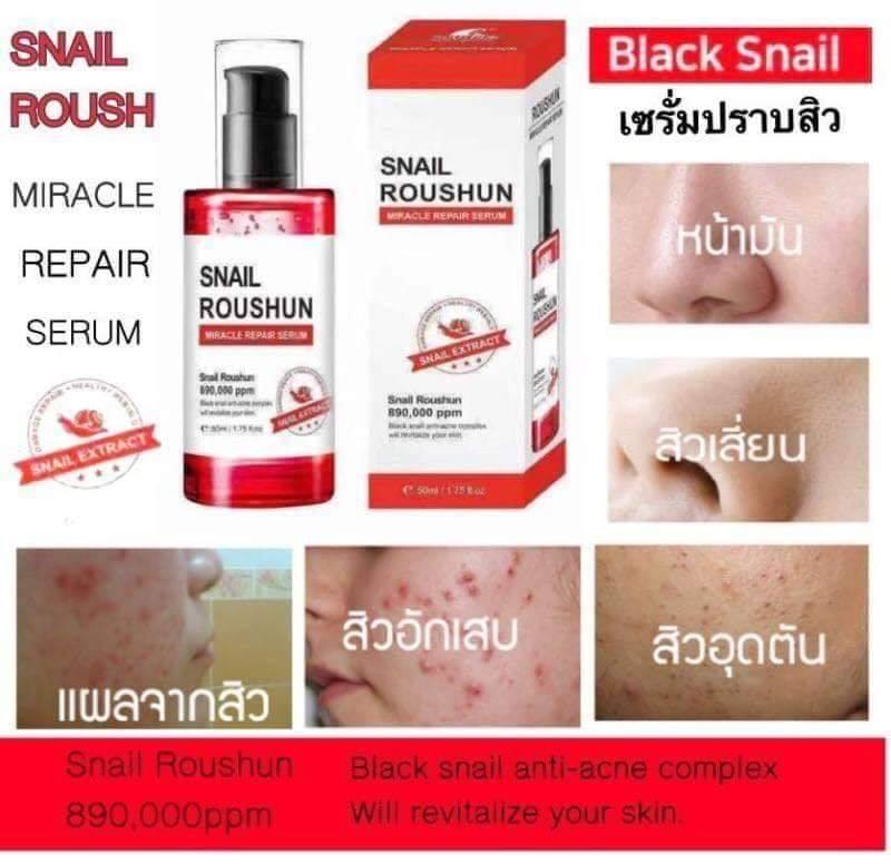 skin repair acne complex