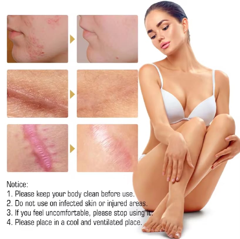Scar Repair Skin Essential Oil Natural Pure Remove Ance Burn Strentch Marks Scar Removal Skin Therapy Oil Remove Scars Stretch Marks Serum Moisturizing Nourish Improve Rough Smooth Fine Lines Lifting Firming Body Care 30ml. 