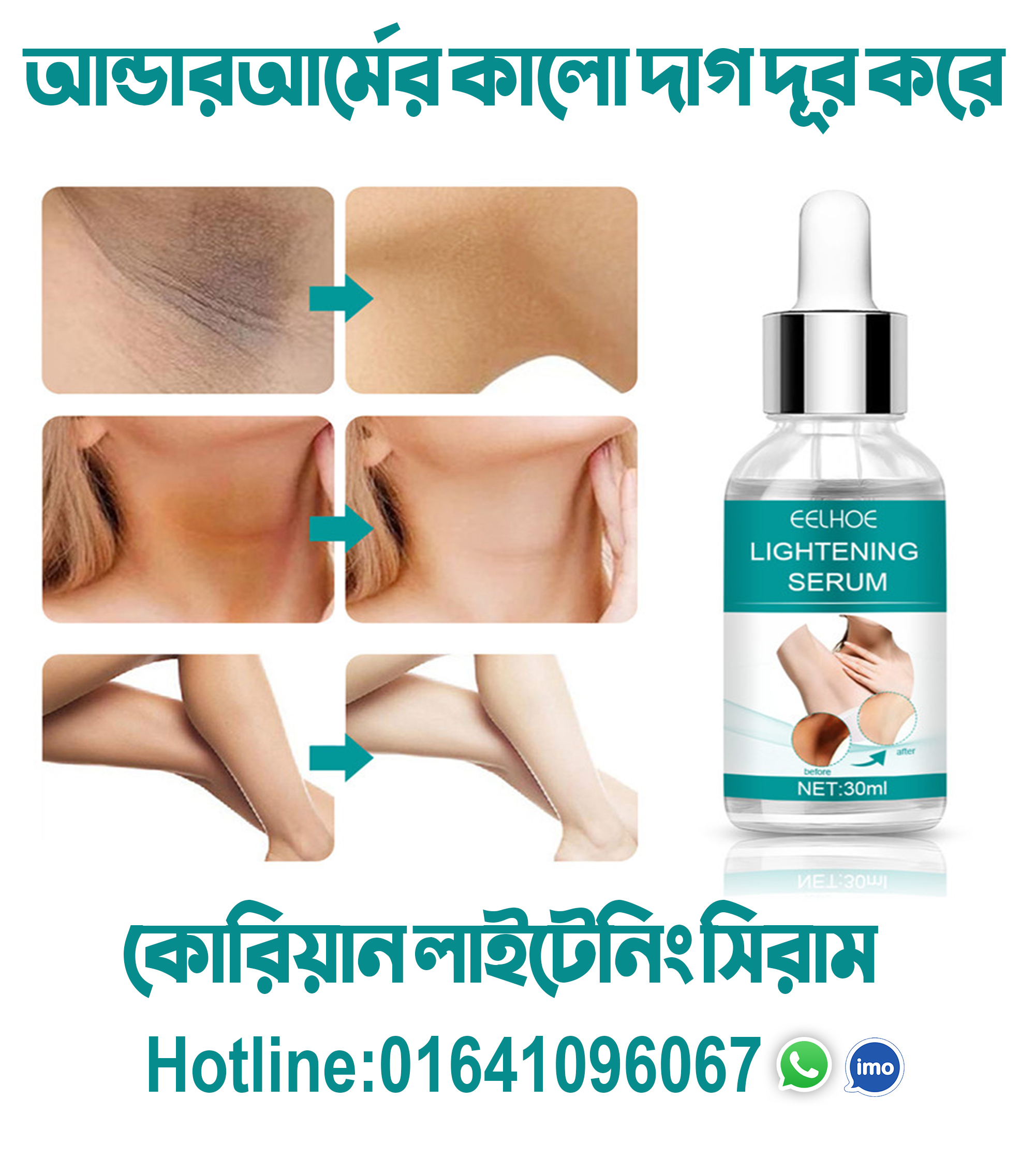 EELHOE Makes Brighter To Your Body And Posture Without Any Side Effect. 