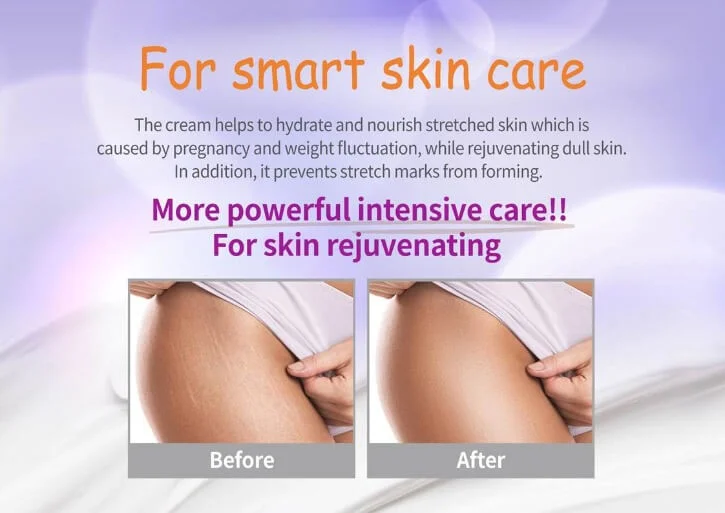 Pax Moly Mom’s Care Stretch Mark Cream -70ml. 