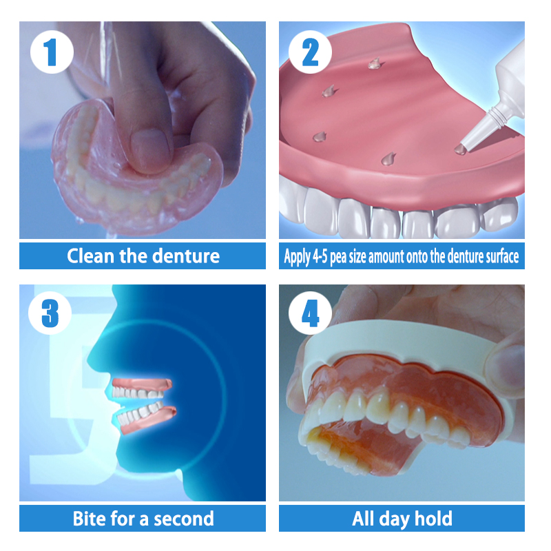 Y-Kelin Denture Adhesive Cream 40g Strong Hold Glue For Cull Partial False Teeth Bonding Prosthesis Fixing BruberryBeE. 