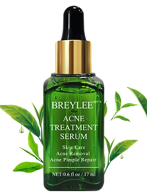 Acne Treatment Serum